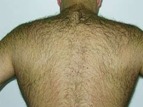 Photo: Hairfree Centre Norwood - Laser hair Removal